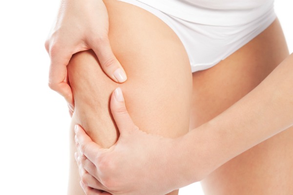 Combattere la cellulite