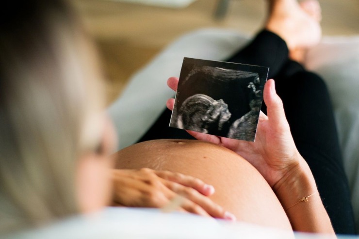 donna incinta che osserva l'ecografia