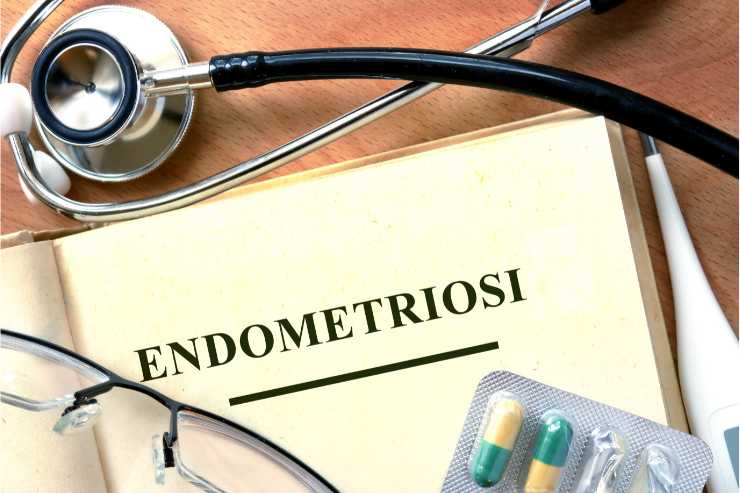 endometriosi stetoscopio e pillole